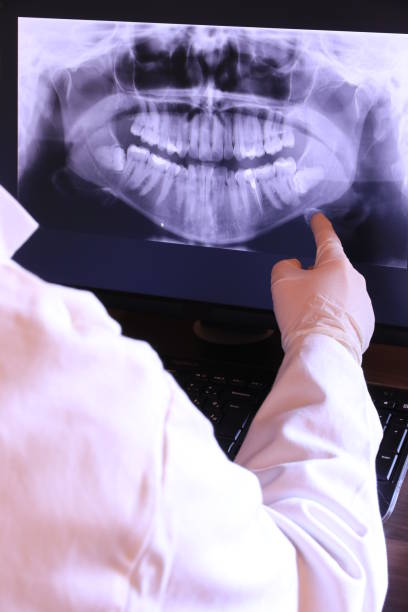 Best Urgent Care for Lost Fillings or Crowns in West Samoset, FL