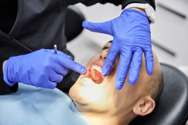 Best Emergency Tooth Extraction in West Samoset, FL